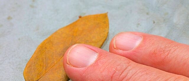 Health Clues in the Fingernails