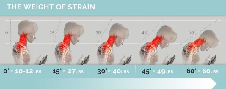 chiropractor taree tech neck