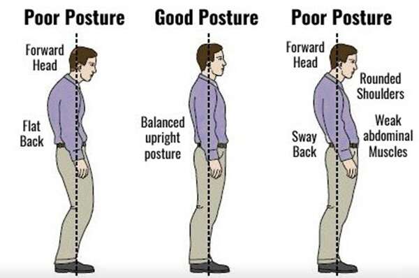taree chiropractic good posture