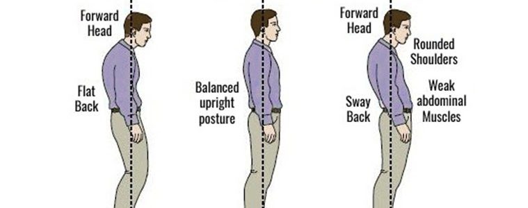 taree chiropractic good posture